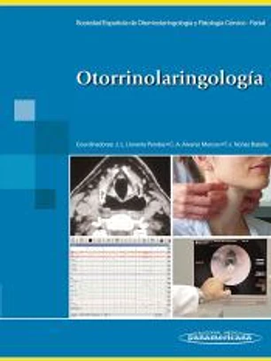 Otorrinolaringología