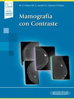 Mamografía con Contraste (+e-book)
