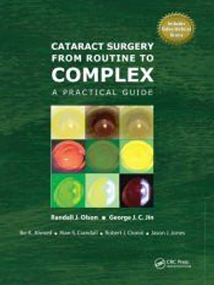 Cataract Surgery from Routine to Complex
