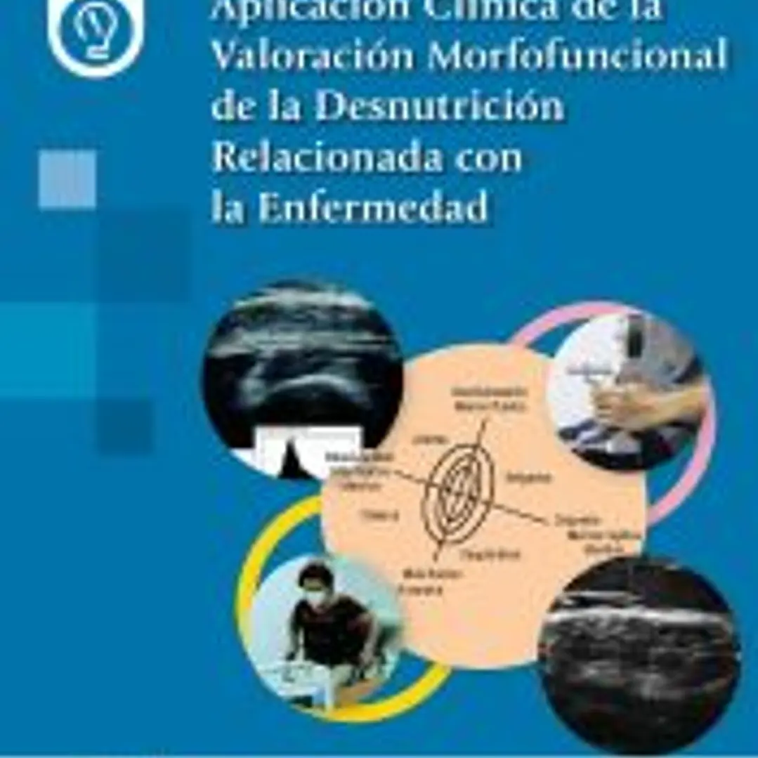 Aplicación Clínica de la Valoración Morfofuncional de la Desnutrición Relacionada con la Enfermedad 1
