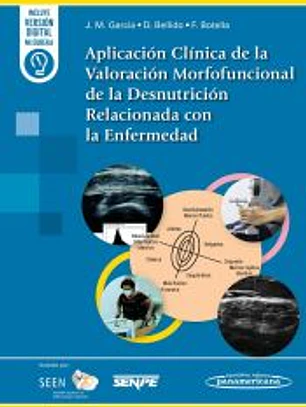 Aplicación Clínica de la Valoración Morfofuncional de la Desnutrición Relacionada con la Enfermedad