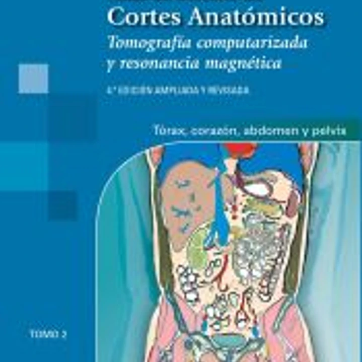 Atlas de Bolsillo de Cortes Anatómicos : Tomografía computarizada y resonancia magnética. Tomo 2, tórax, corazón, abdomen y pelvis 1