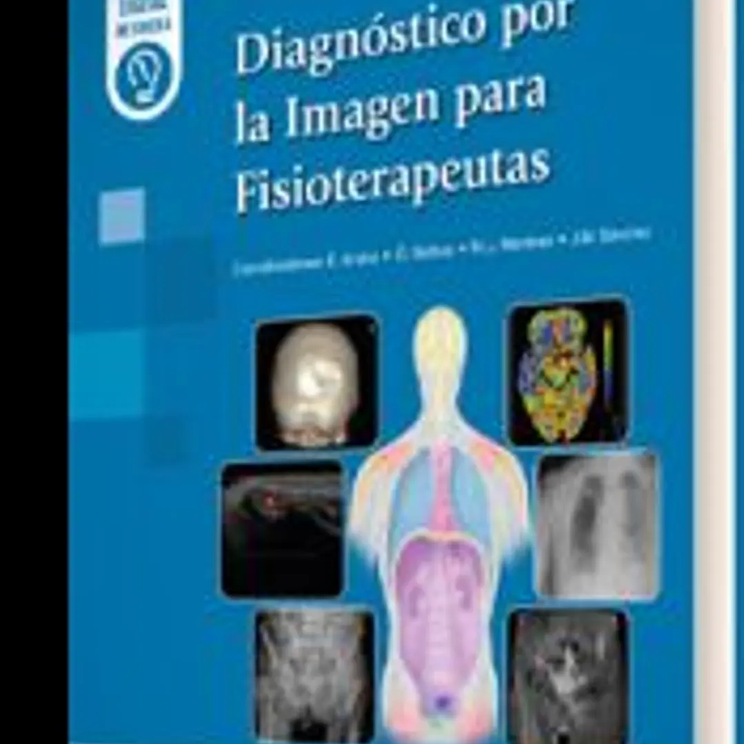 Diagnóstico por la Imagen para Fisioterapeutas 1