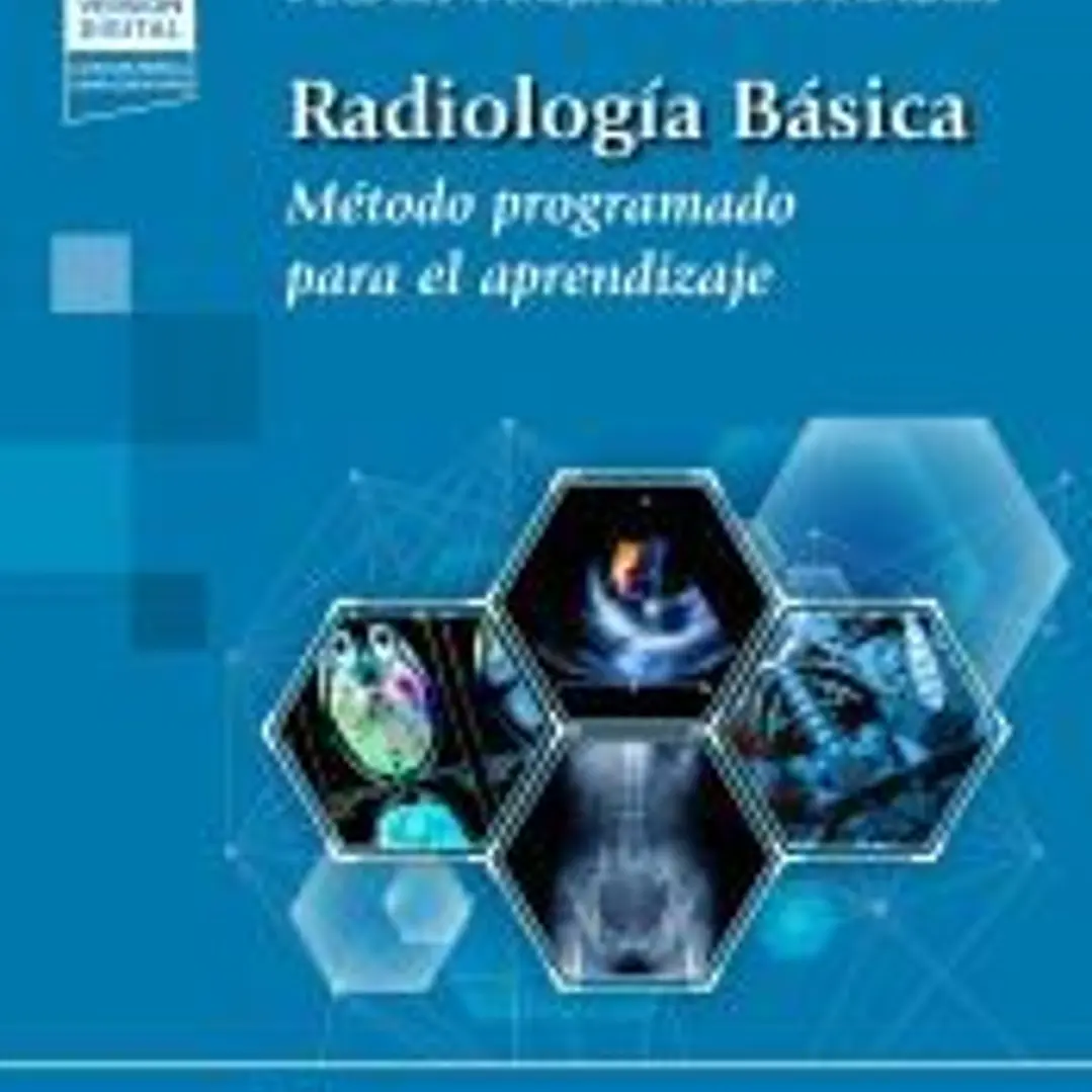 Radiología Básica (+ e-book): Método programado para el aprendizaje 1