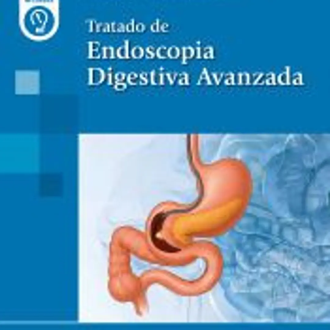 Tratado de Endoscopia Digestiva Avanzada 1