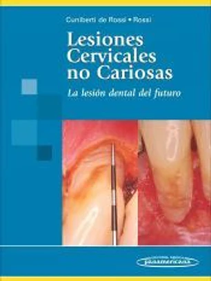 Lesiones Cervicales no Cariosas. La Lesión dental del futuro