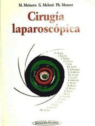 Cirugía Laparoscópica
