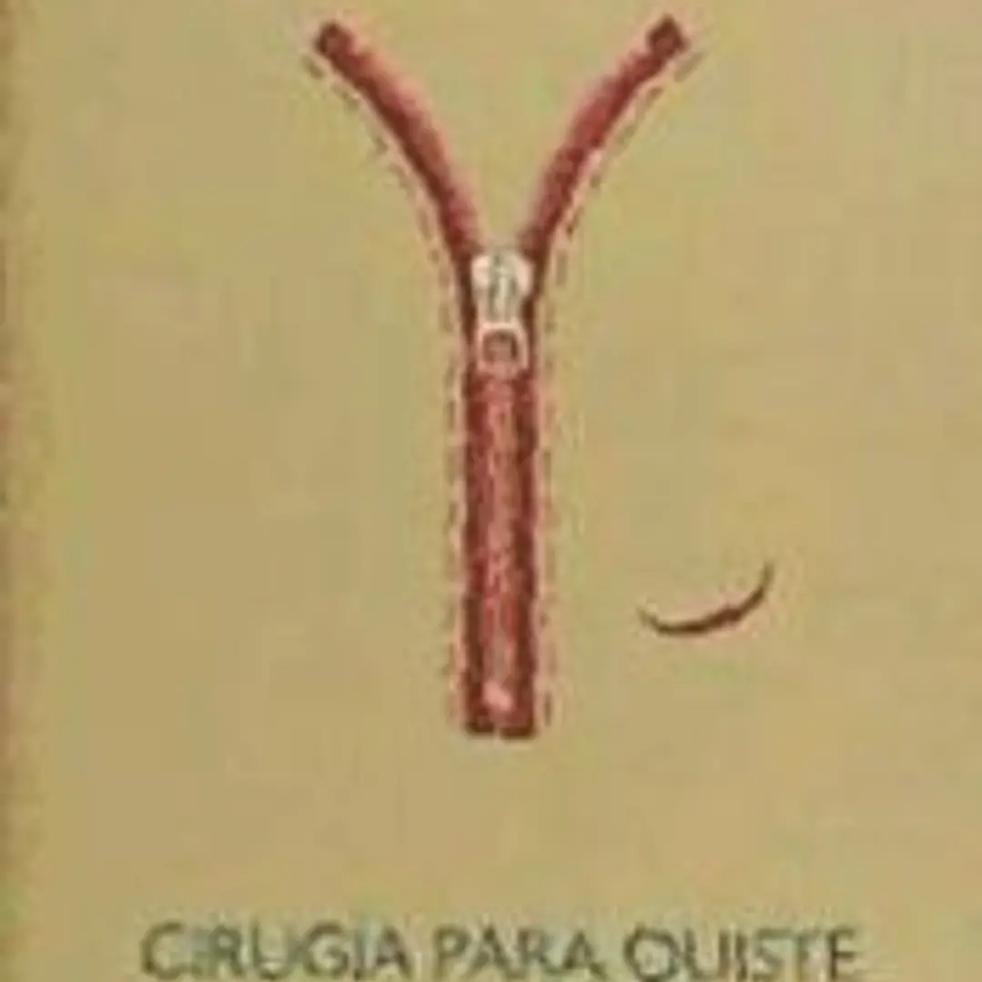 CIRUGIA PARA QUISTE DEL EPIDIDIMO 1