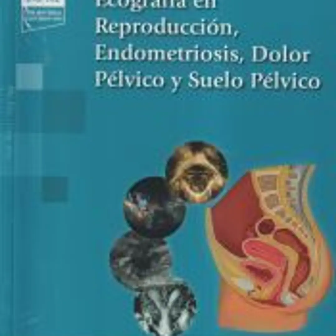 Ecografía en Reproducción, Endometriosis, Dolor Pélvico y Suelo Pélvico (+e-book) 1