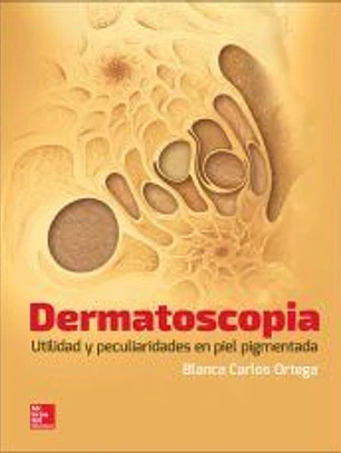 DERMATOSCOPIA UTILIDAD Y PECULIARIDADES EN PIEL PIGMENTADA