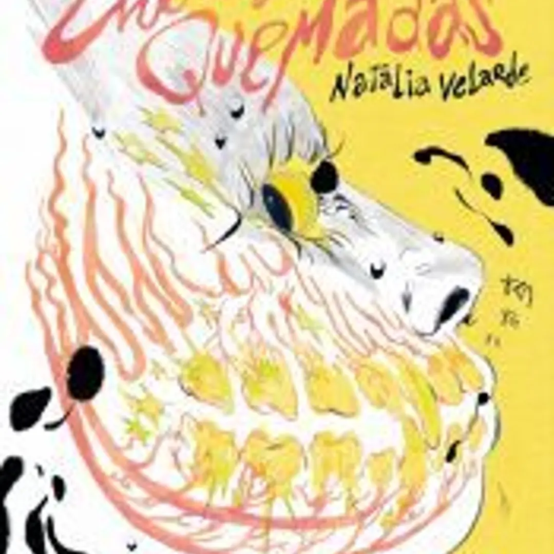 Encías quemadas 1