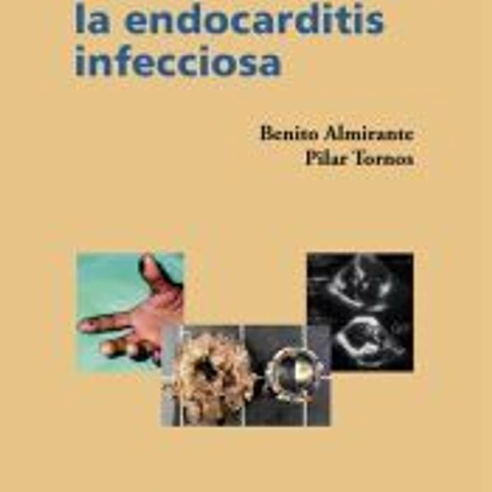 Actualización en la endocarditis infecciosa 1