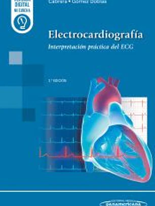 ELECTROCARDIOGRAMA:INTERPRETACION PRACTICA DEL EGG