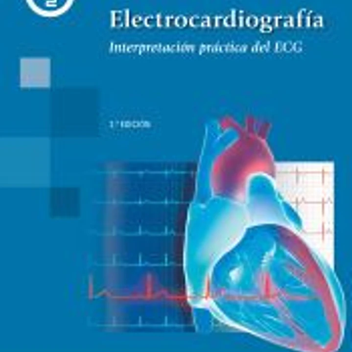 ELECTROCARDIOGRAMA:INTERPRETACION PRACTICA DEL EGG 1
