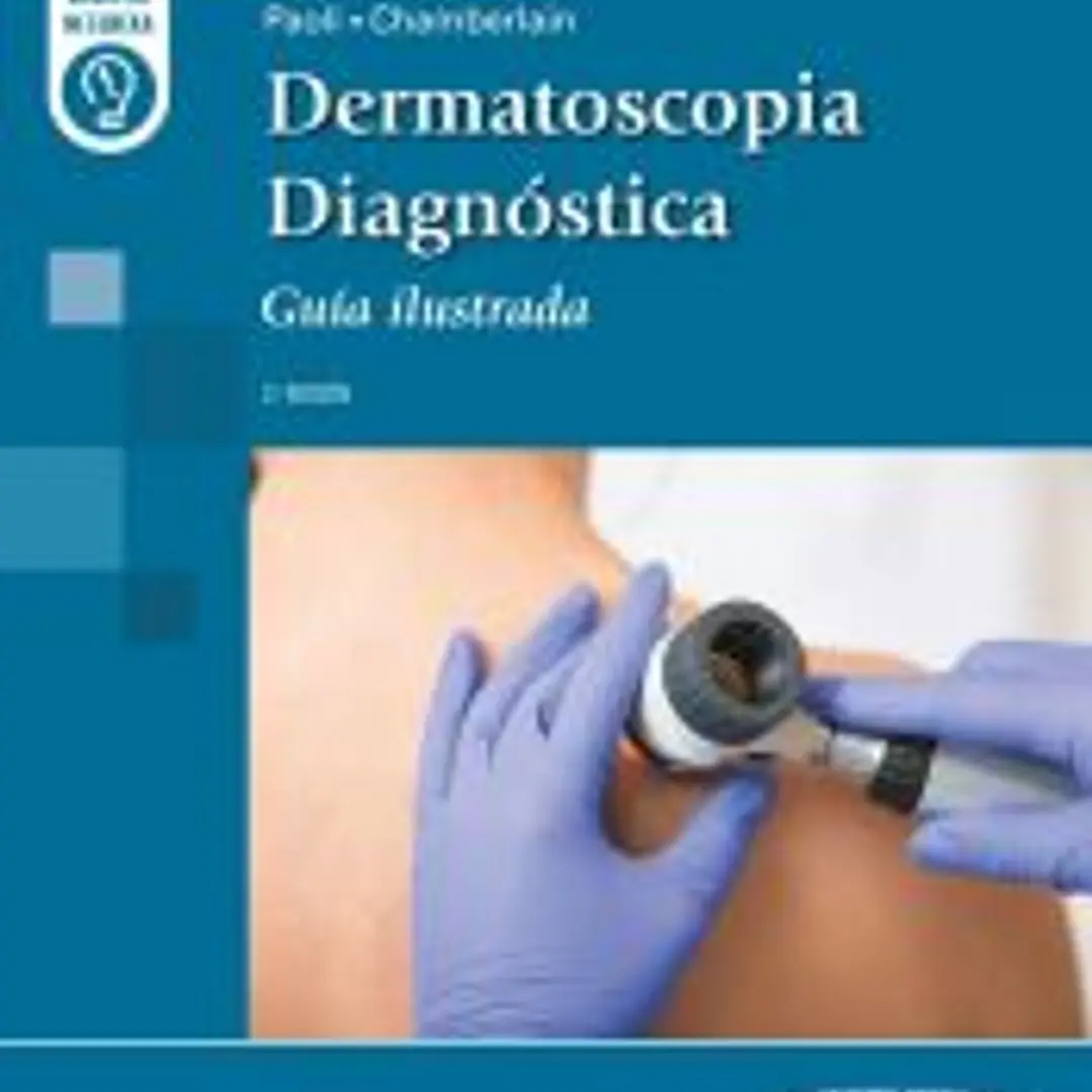 Dermatoscopia Diagnóstica 1