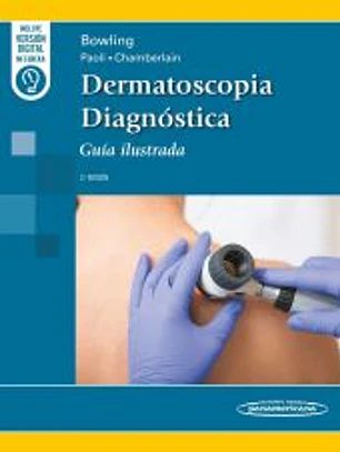 Dermatoscopia Diagnóstica