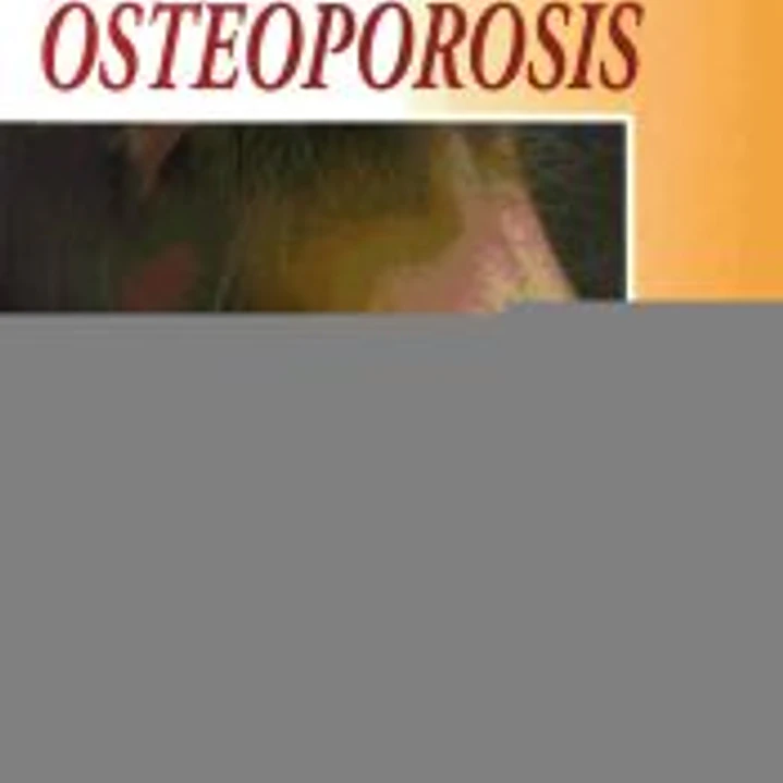 LUCHE CONTRA LA OSTEOPOROSIS 1