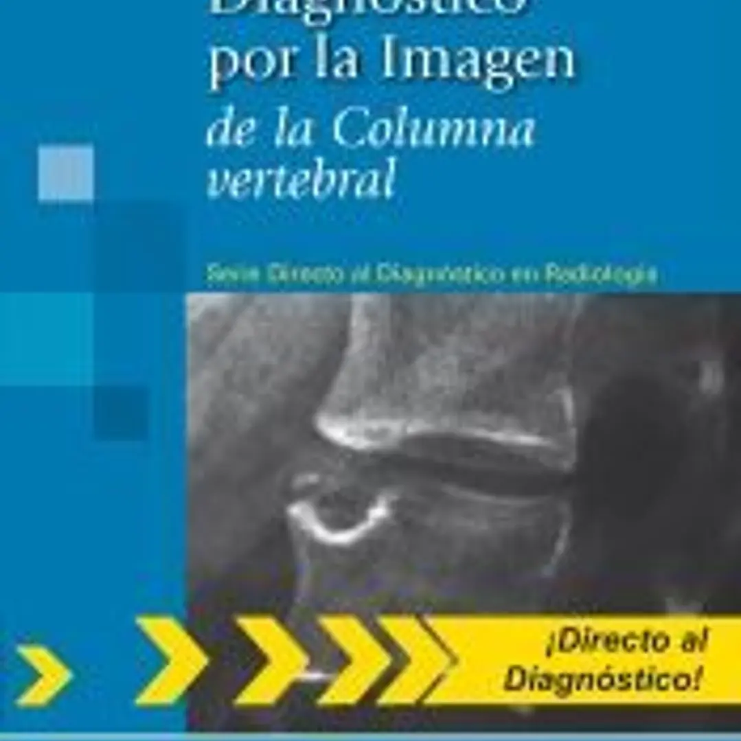 Diagnóstico por la Imagen de la Columna vertebral. (Serie Directo al Diagnóstico en Radiología) 1
