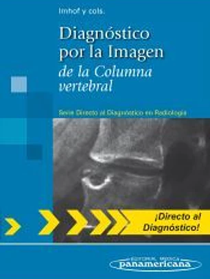 Diagnóstico por la Imagen de la Columna vertebral. (Serie Directo al Diagnóstico en Radiología)