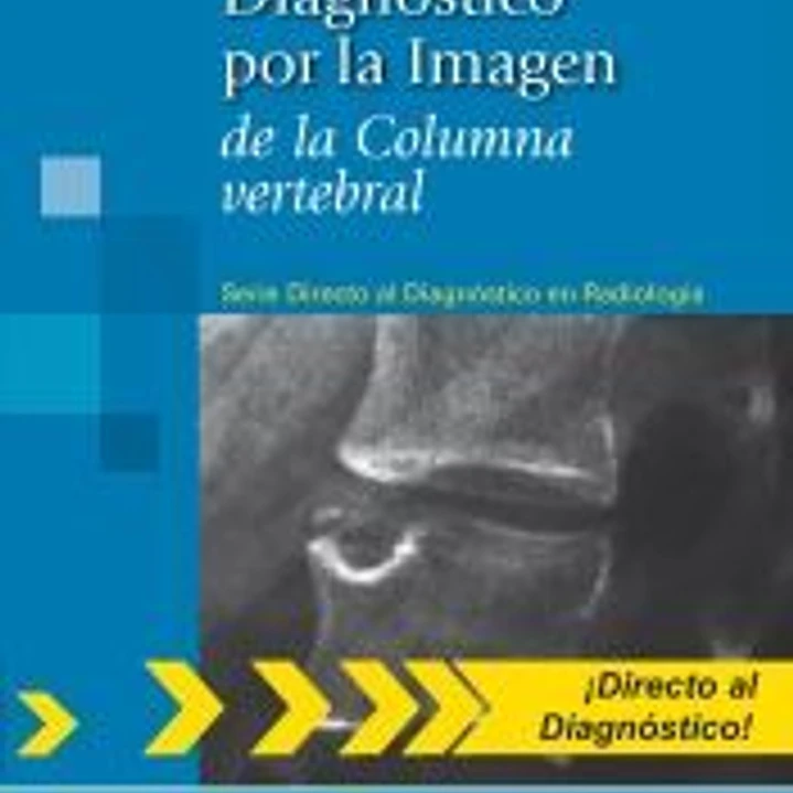 Diagnóstico por la Imagen de la Columna vertebral. (Serie Directo al Diagnóstico en Radiología) 1
