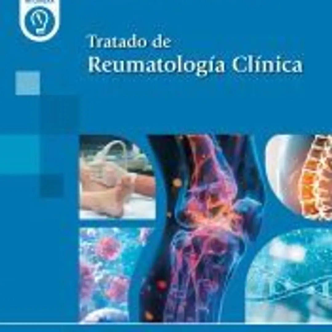 Tratado de Reumatología Clínica 1