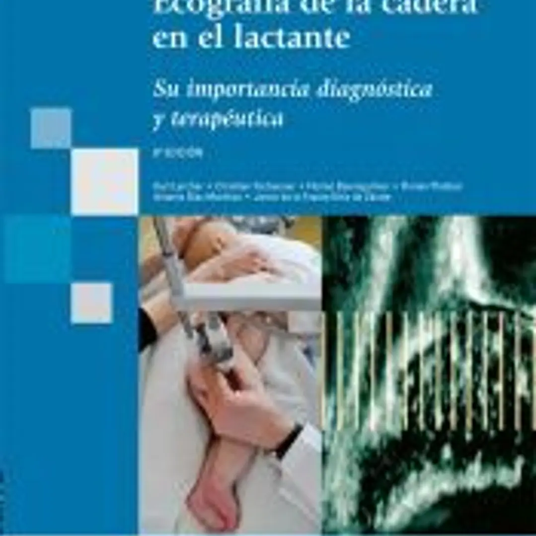 ECOGRAFÍA EN LA CADERA DEL LACTANTE. Su importancia diagnóstica y terapeútica 1