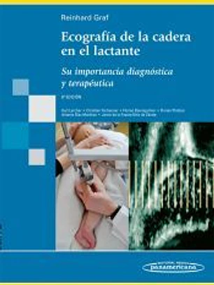 ECOGRAFÍA EN LA CADERA DEL LACTANTE. Su importancia diagnóstica y terapeútica