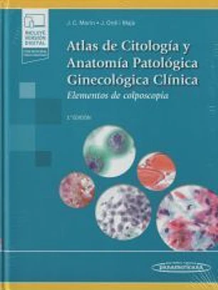 Atlas de Citología y Anatomía Patológica Ginecológica Clínica: Elementos de colposcopia