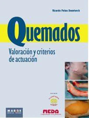 QUEMADOS VALORACION Y CRITERIOS DE ACTUACION