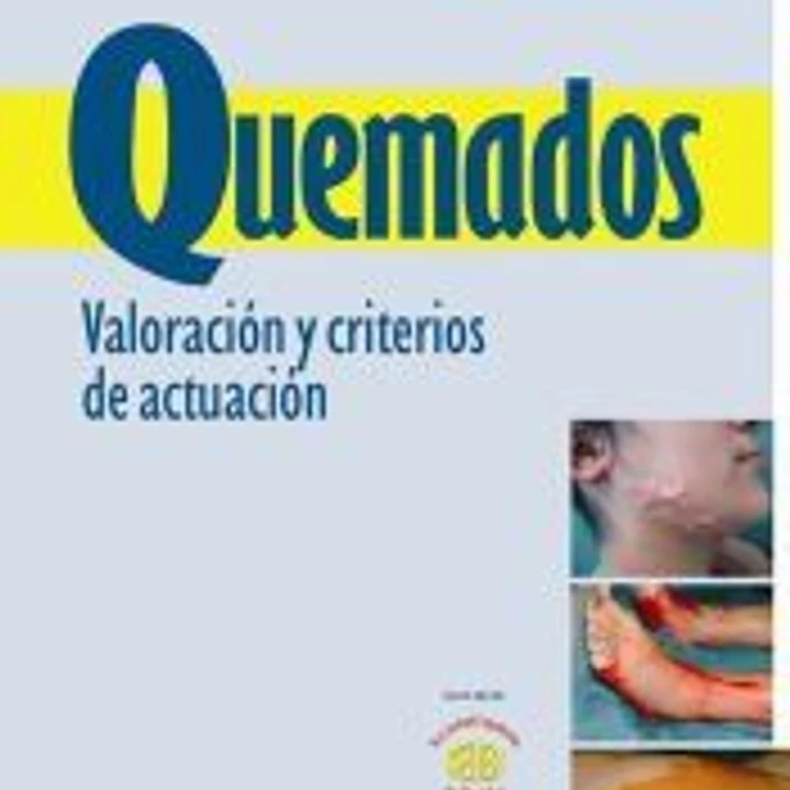 QUEMADOS VALORACION Y CRITERIOS DE ACTUACION 1