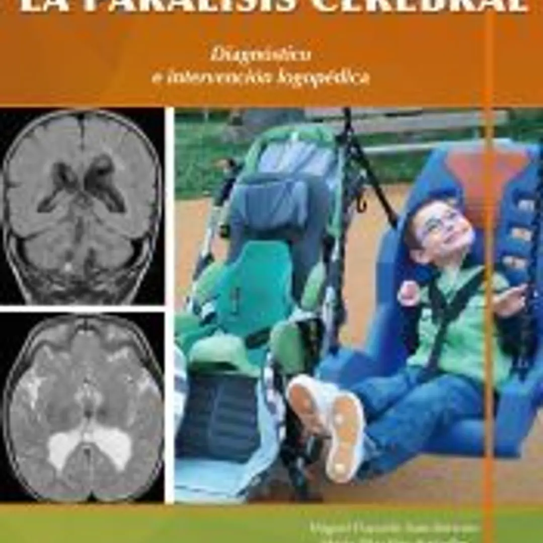 La Parálisis Cerebral. Diagnóstico e Intervención Logopédica 1
