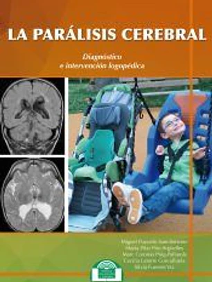 La Parálisis Cerebral. Diagnóstico e Intervención Logopédica