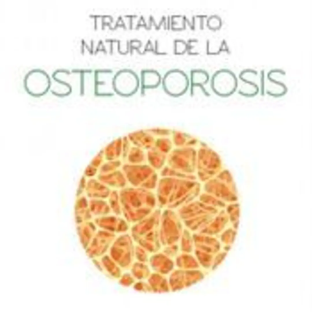 Tratamiento natural de la osteoporosis 1