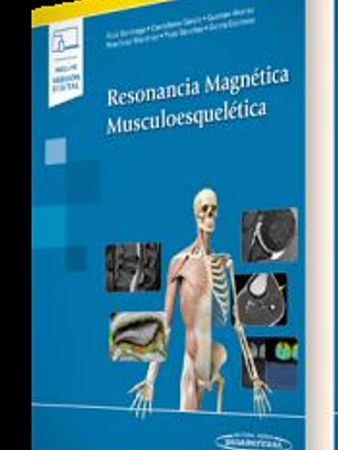 Resonancia Magnética Musculoesquelética
