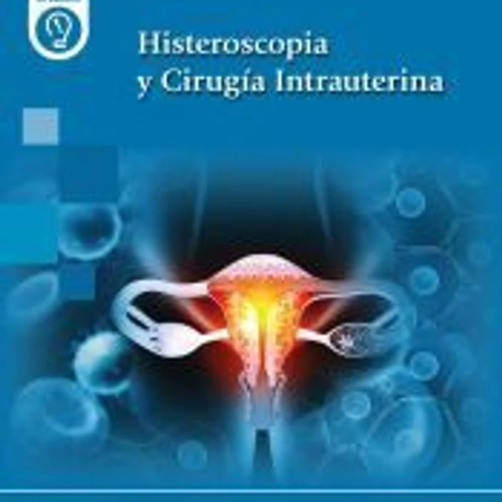 Histeroscopia y Cirugía Intrauterina 1