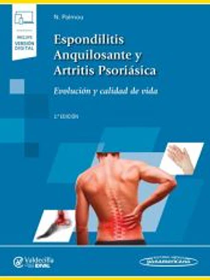 Espondilitis Anquilosantes y Artritis Psriásica+versión digital