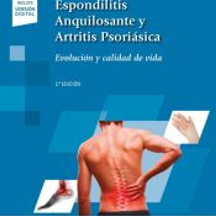 Espondilitis Anquilosantes y Artritis Psriásica+versión digital 1