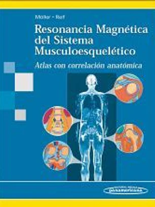 Resonancia Magnética del Sistema Musculoesquelético. Atlas con correlación anatómica