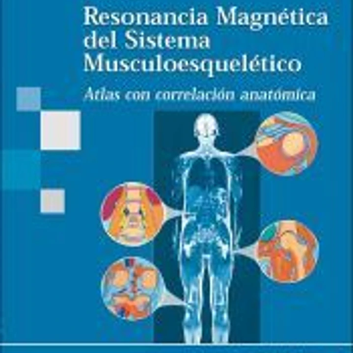 Resonancia Magnética del Sistema Musculoesquelético. Atlas con correlación anatómica 1