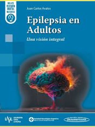 Epilepsia en Adultos          