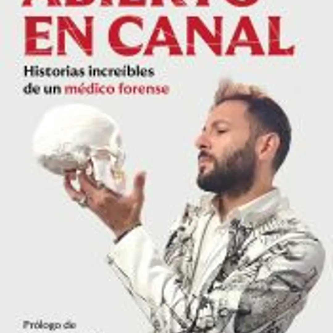 Abierto en canal 1