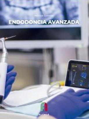 ENDODONCIA AVANZADA