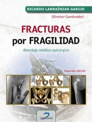 Fracturas por fragilidad