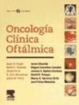 Oncología clínica oftálmica