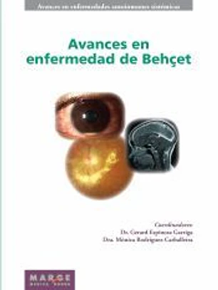 AVANCES EN ENFERMEDAD DE BEHCET