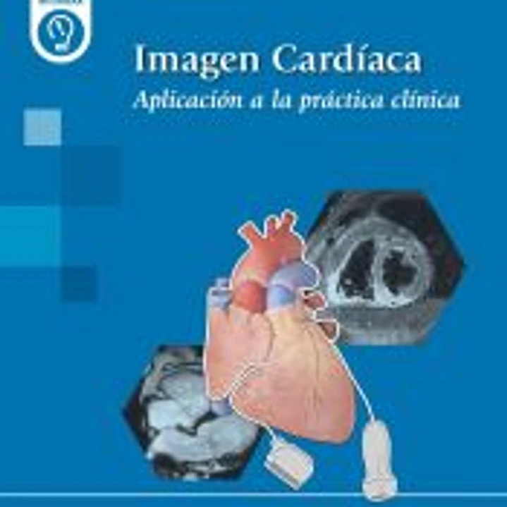 Imagen Cardíaca: Aplicación a la práctica clínica 1