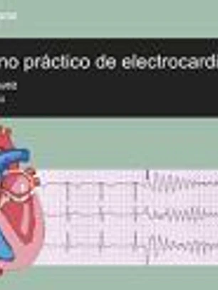 CUADERNO PRACTICO DE ELECTROCARDIOGRAFIA