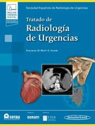 TRATADO DE RADIOLOGIA DE URGENCIAS