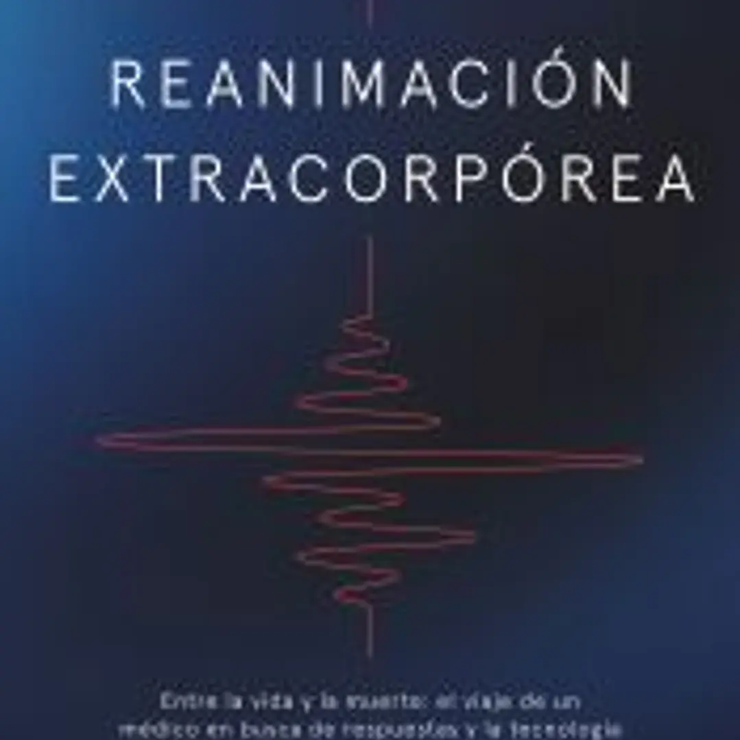 Reanimación extracorpórea 1