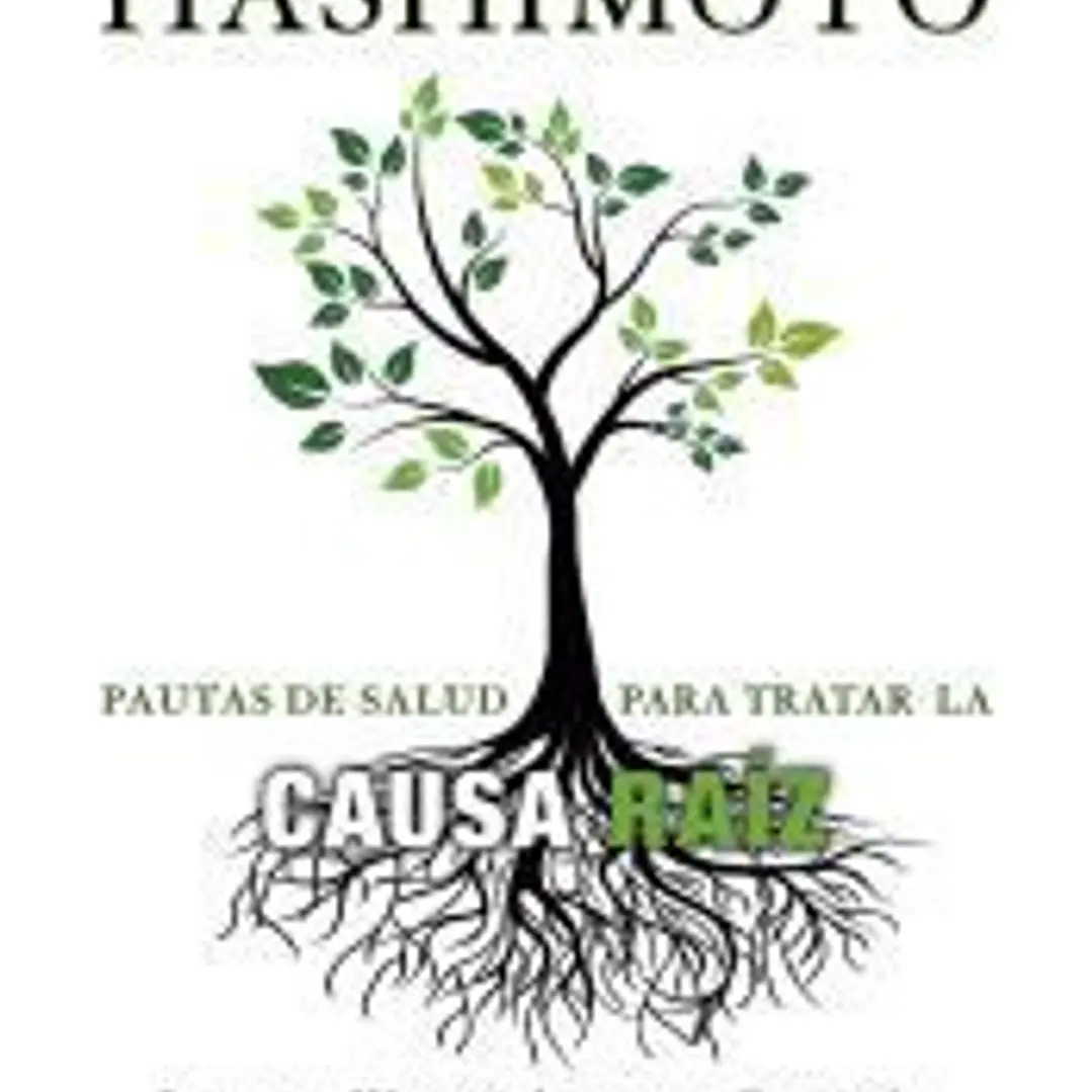 Tiroiditis de Hashimoto 1